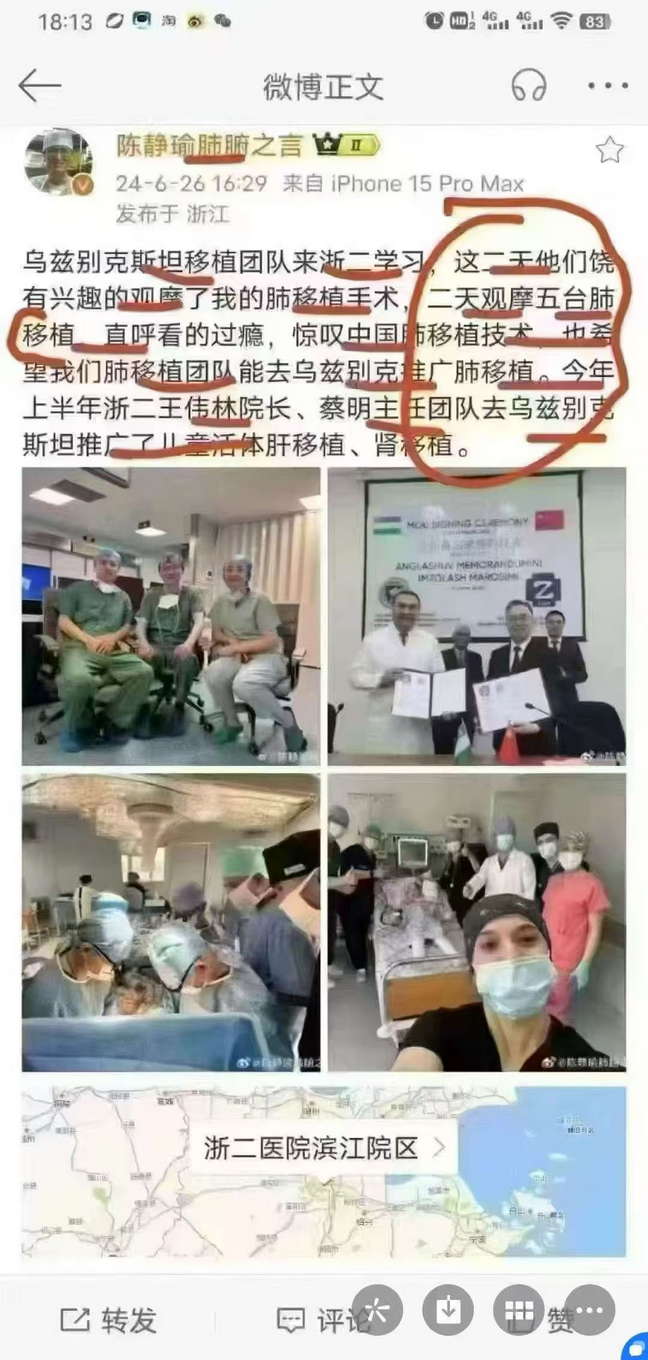 乌兹别克斯坦移植团队来浙二学习，二天观摩五台肺移植，直呼看的过瘾，惊叹中国肺移植技术