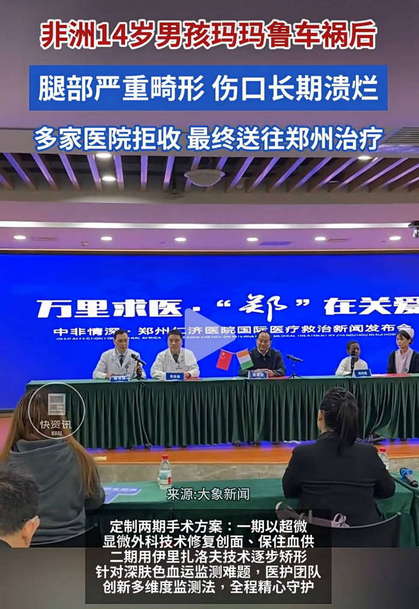 非洲14岁男孩玛玛鲁车祸后腿部严重畸形最终送往郑州治疗