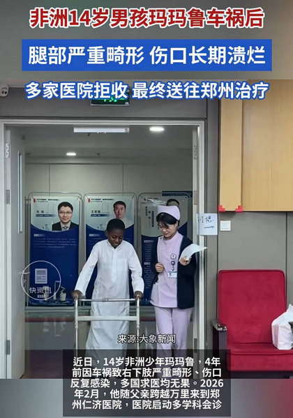 非洲14岁男孩玛玛鲁车祸后腿部严重畸形最终送往郑州治疗